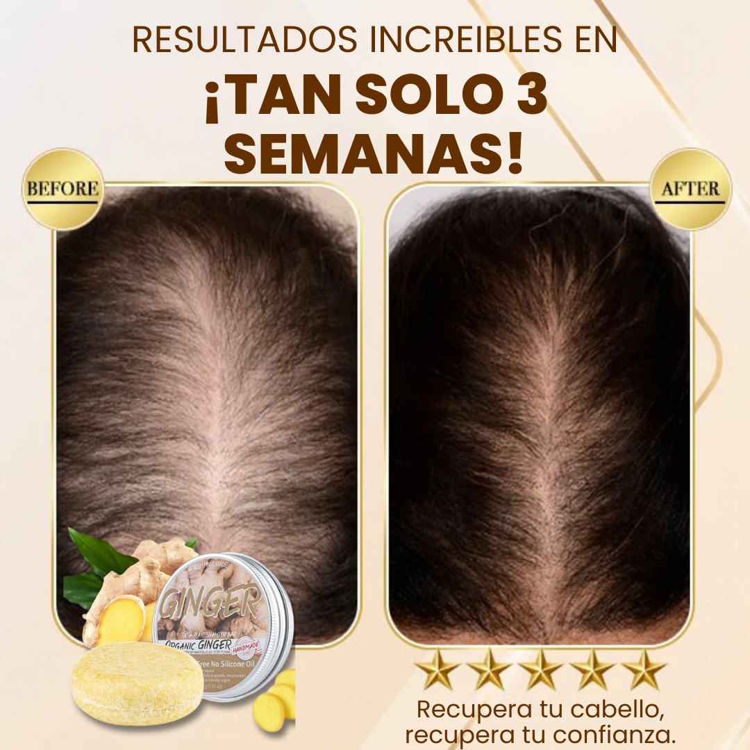 Herbal Essences, Champú De Volumen Con Ingredientes De Origen Natural, Para Cabello