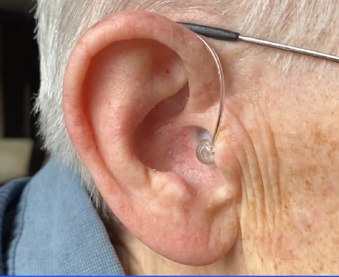 ¡EXCLUSIVO! AUDIFONO RETICULAR SENIOR SOUND