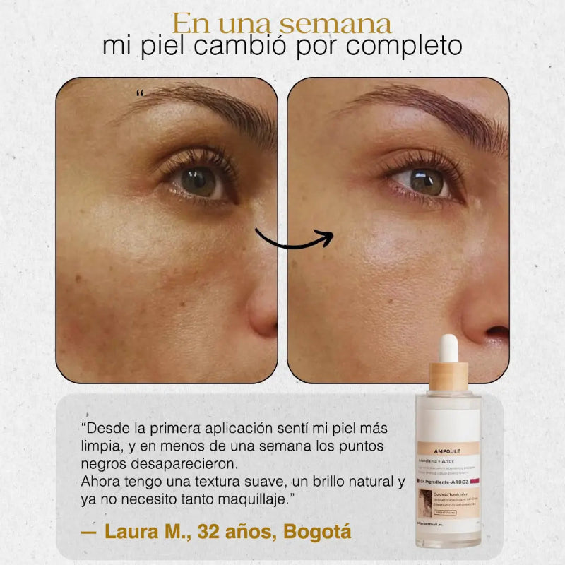 PURESKIN - LIMPIADOR DÚO, LIMPIA, ELIMINA PUNTOS NEGROS Y DISMINUYE POROS ABIERTOS