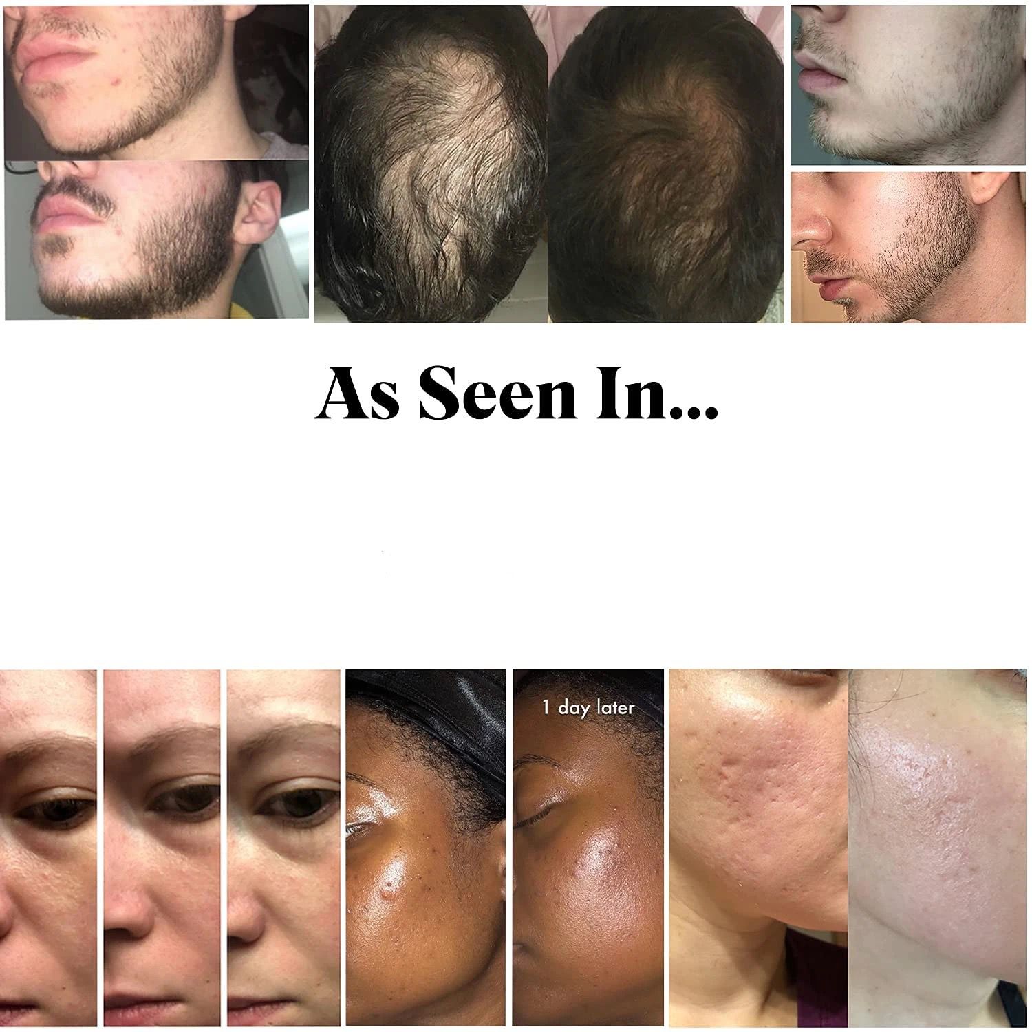 ¡EXCLUSIVO! HYDRAROLLER RODILLO EFECTIVO PARA TRATIMIENTOS CAPILARES