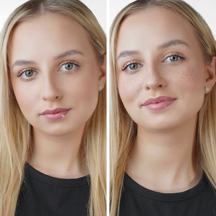 ❣️💎PRODUCTO EN TENDENCIA 😍🥰 PACK DE 6 PARCHES DE PECAS- SENSACION