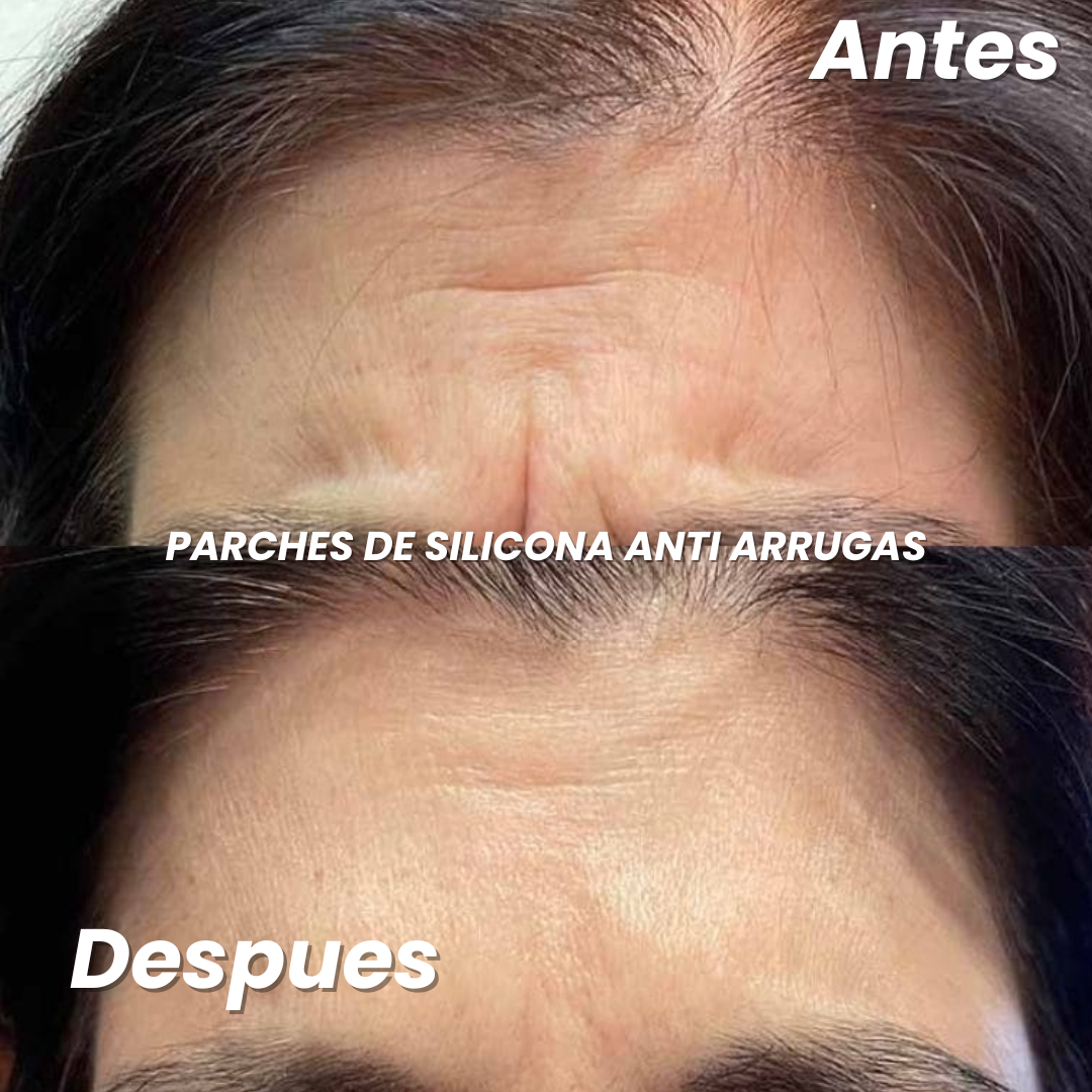 ¡EXCLUSIVO!  BELLA TAPE ® | PARCHES  DE  SILICONA ANTI ARRUGAS