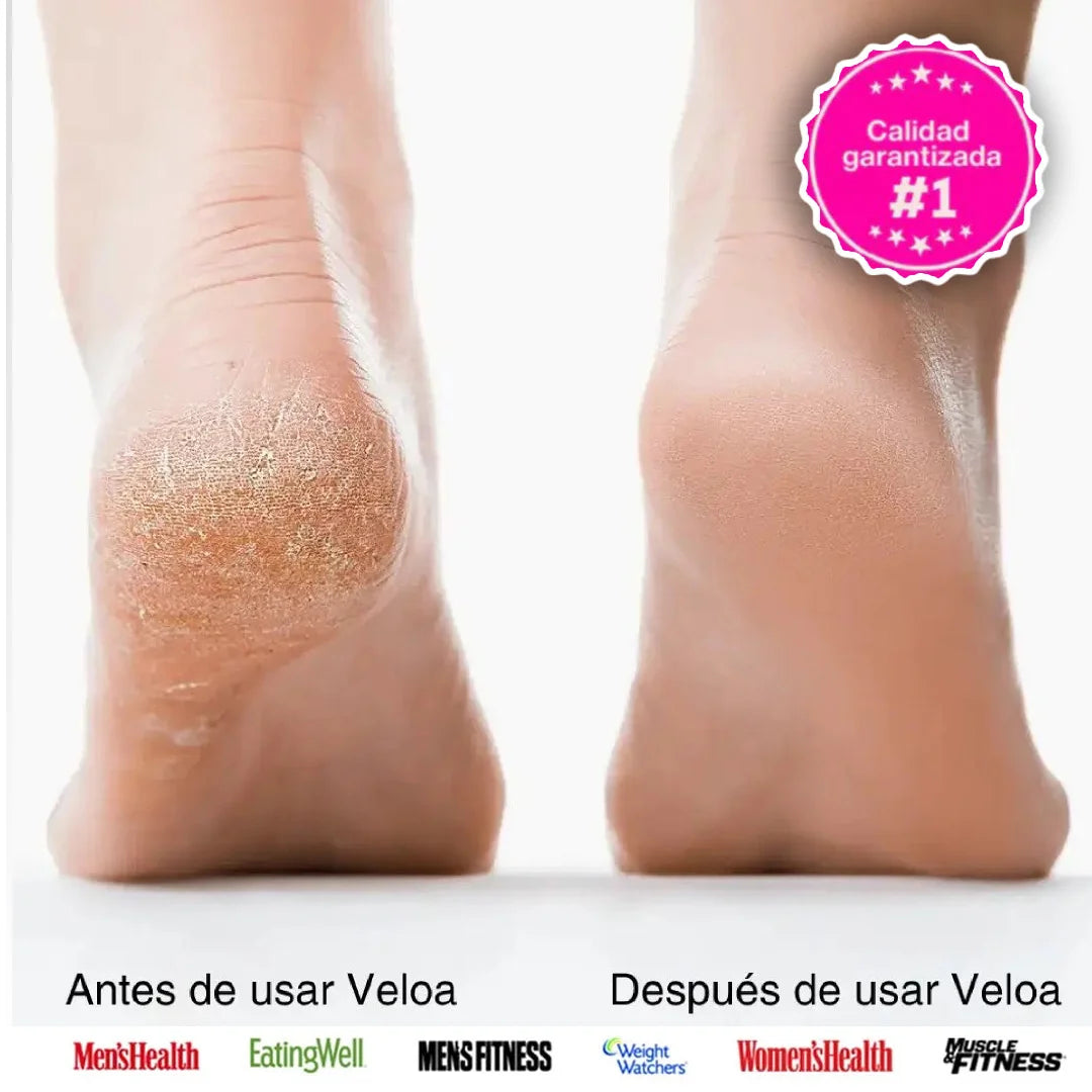 VELOA, PIES DE TERCIOPELO -  LIMA ELÉCTRICA PARA PIES, ELIMINA CALLOS EN SEGUNDOS DESDE CASA