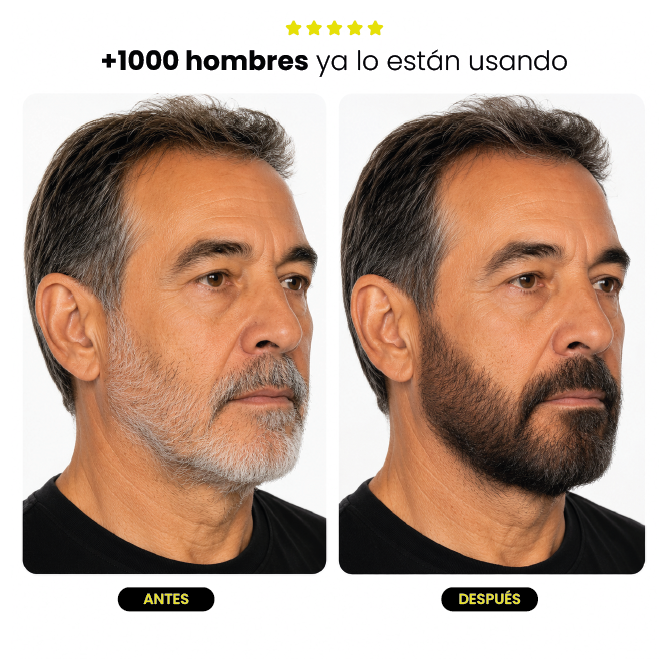 BARBA FIX | CORRECTOR TEMPORAL PARA BARBA