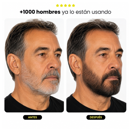 BARBA FIX | CORRECTOR TEMPORAL PARA BARBA