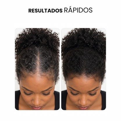 CORRECTOR CAPILAR PARA MUJER | EFECTO INMEDIATO