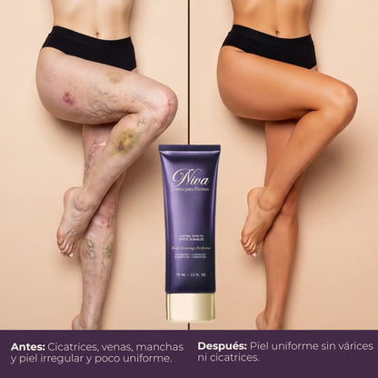 NIVA CREMA PARA PIERNAS | CUBRE MANCHAS Y OCULTA VENAS AL INSTANTE