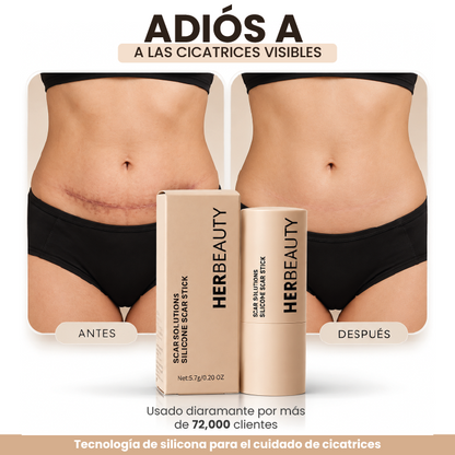 DERMA PLUS | TRATAMIENTO DE SILICONA PARA CICATRICES DE ABDOMINOPLASTIA | PIEL MÁS SUAVE Y UNIFORME