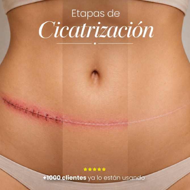 DERMA PLUS | TRATAMIENTO DE SILICONA PARA CICATRICES DE ABDOMINOPLASTIA | PIEL MÁS SUAVE Y UNIFORME