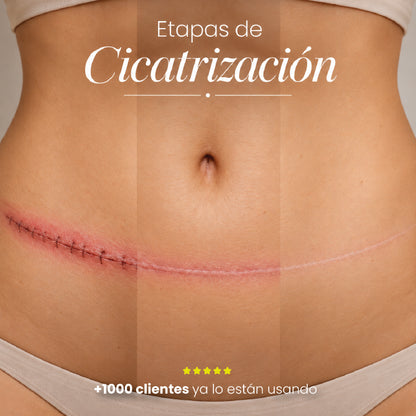 DERMA PLUS | TRATAMIENTO DE SILICONA PARA CICATRICES DE ABDOMINOPLASTIA | PIEL MÁS SUAVE Y UNIFORME