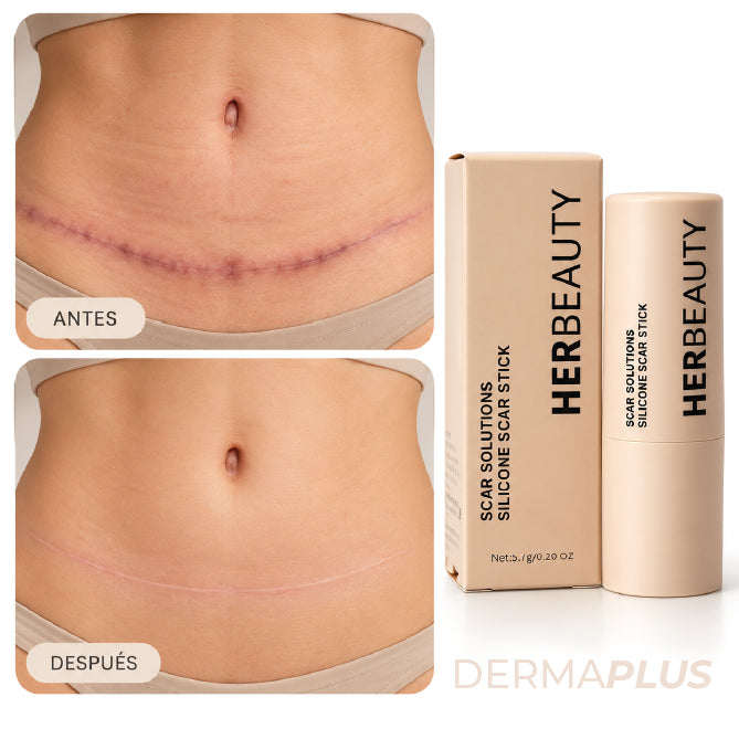 DERMA PLUS | TRATAMIENTO DE SILICONA PARA CICATRICES DE ABDOMINOPLASTIA | PIEL MÁS SUAVE Y UNIFORME