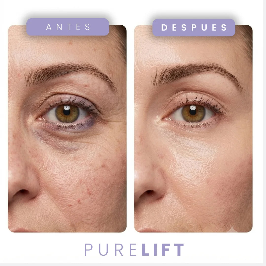 EYE-LIFT PRO | Tensor Instantáneo | CORRECTOR INSTANTANEO DE APARIENCIA