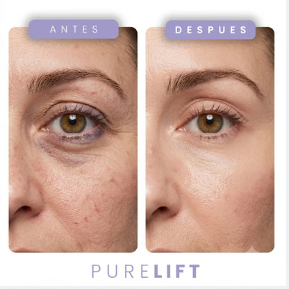 EYE-LIFT PRO | Tensor Instantáneo | CORRECTOR INSTANTANEO DE APARIENCIA