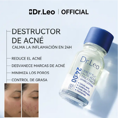 ¡PRODUCTO IMPORTADO 🇺🇲! 🇺🇸 | Destructor de Acné Dr.Leo + hisopo de aplicación✨