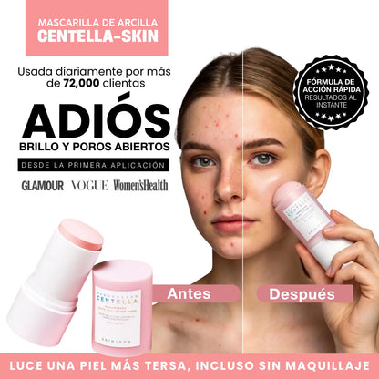CENTELLA - SKIN MASCARILLA DE ARCILLA | ADIOS PIEL GRASOSA Y POROS ABIERTOS