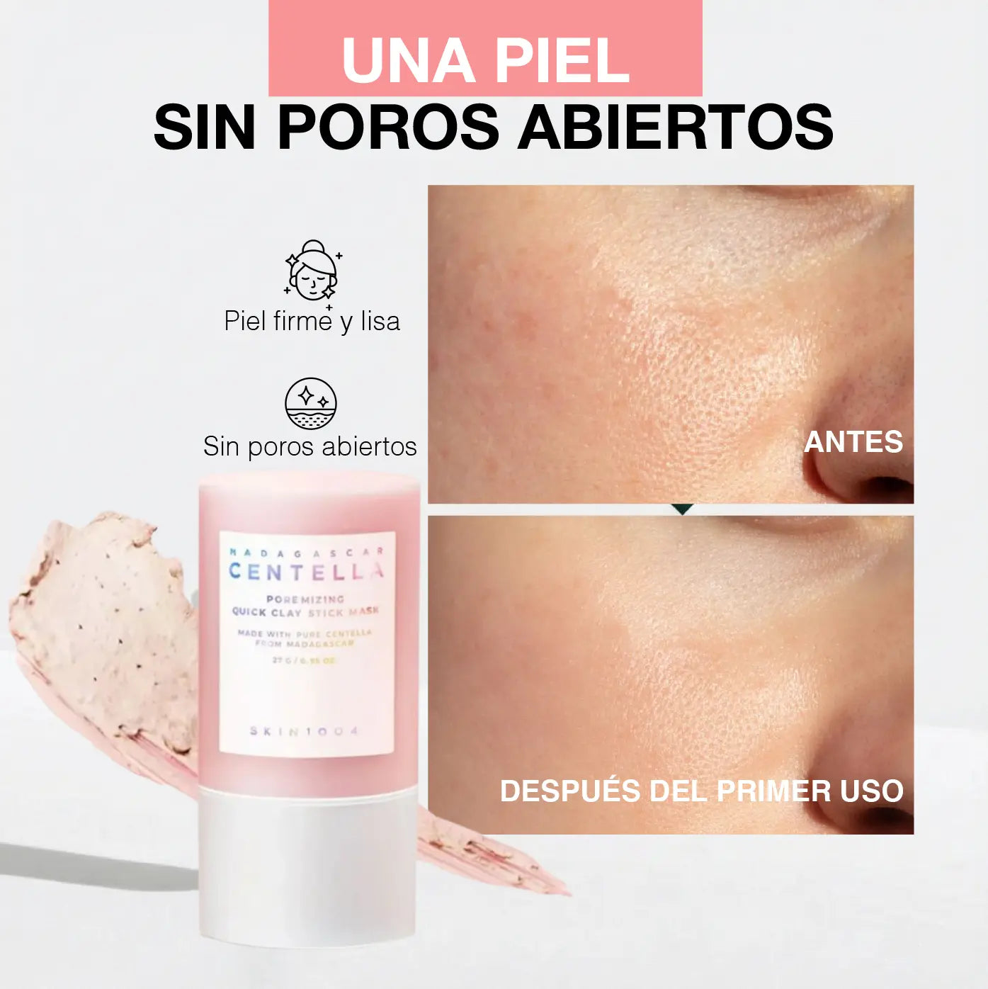 CENTELLA - SKIN MASCARILLA DE ARCILLA | ADIOS PIEL GRASOSA Y POROS ABIERTOS