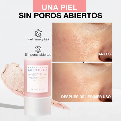 CENTELLA - SKIN MASCARILLA DE ARCILLA | ADIOS PIEL GRASOSA Y POROS ABIERTOS