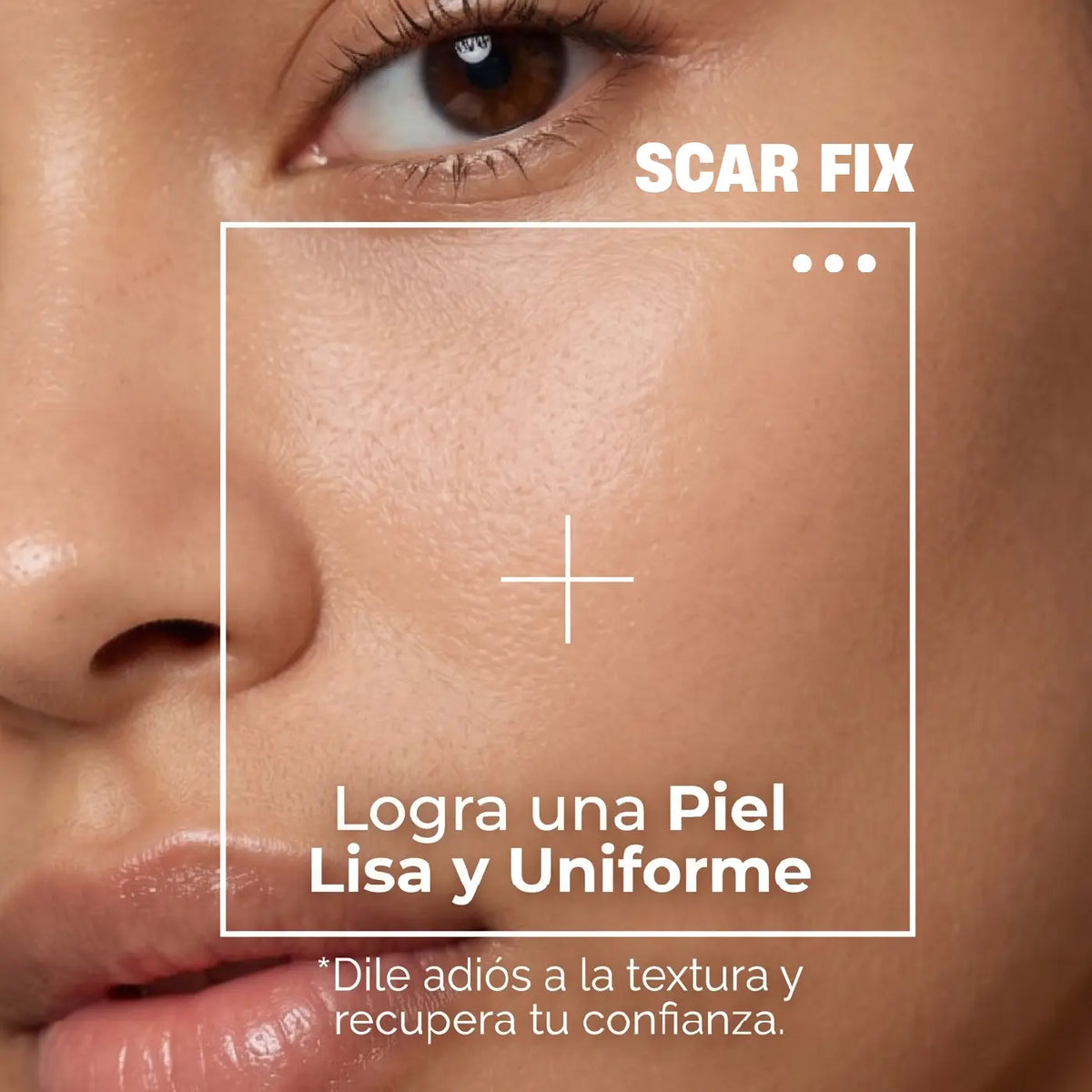 SCAR FIX | TRATAMIENTO REPARADOR DE CICATRICES DE ACNÉ | PIEL LISA EN SEGUNDOS