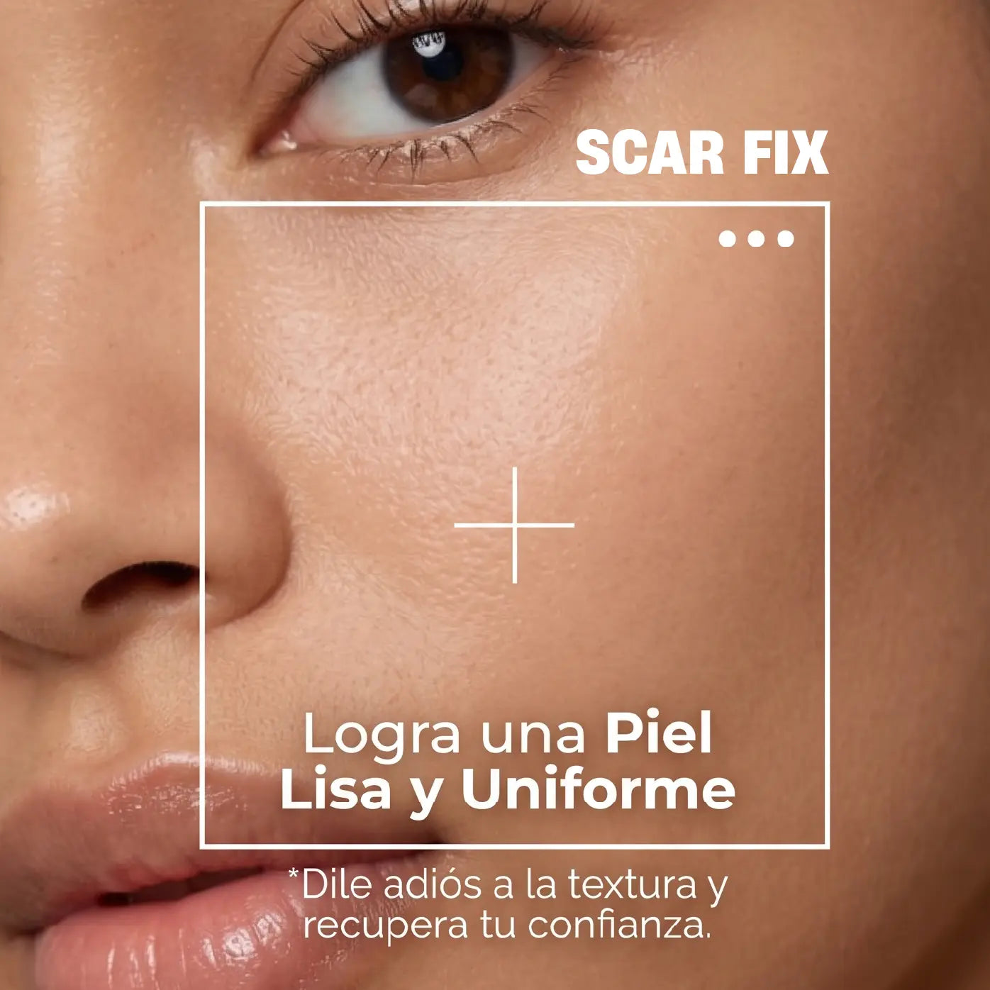 SCAR FIX | TRATAMIENTO REPARADOR DE CICATRICES DE ACNÉ | PIEL LISA EN SEGUNDOS