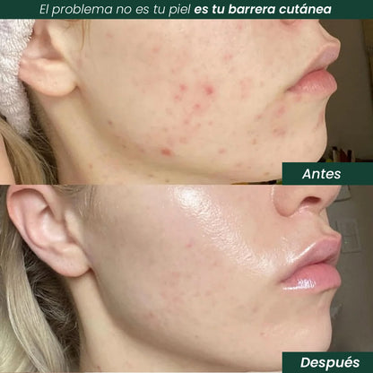 Crema de Recuperación Facial