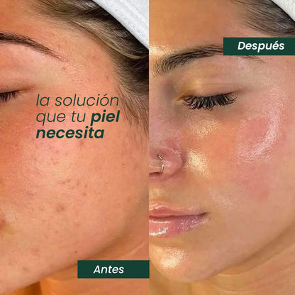 Crema de Recuperación Facial