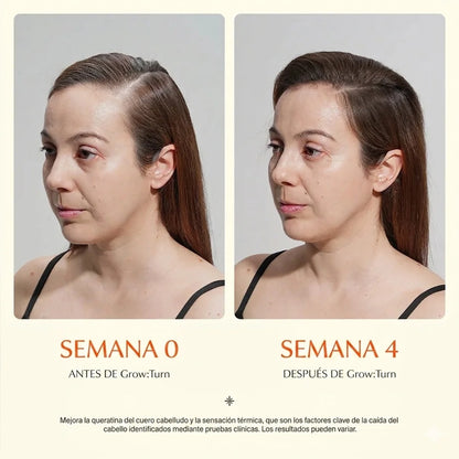 SERUM REGENERADOR CON MASAJEADOR| Adios caida