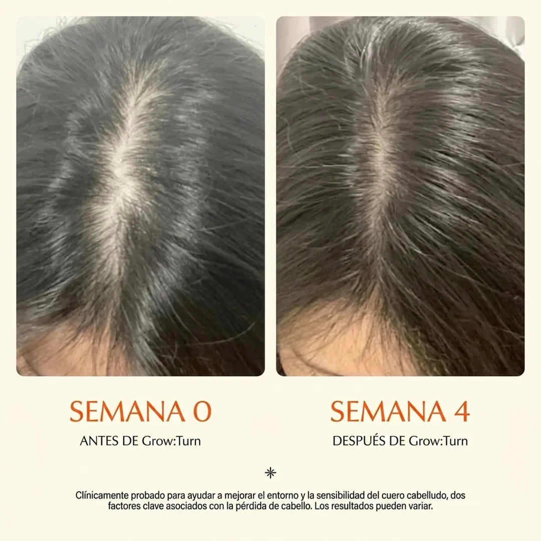 SERUM REGENERADOR CON MASAJEADOR| Adios caida