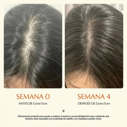 SERUM REGENERADOR CON MASAJEADOR| Adios caida