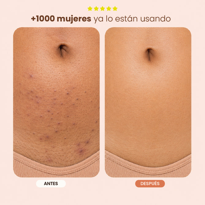 Serum 3 en 1  Skin Care para la línea del bikini
