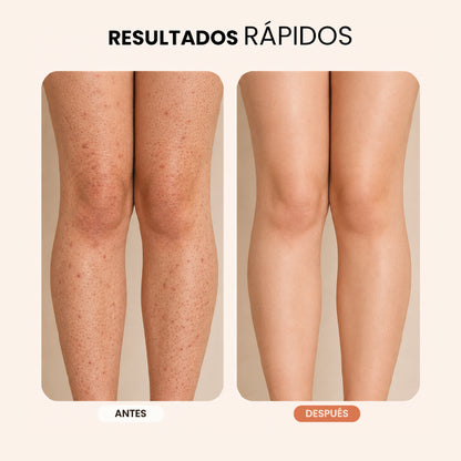 Serum 3 en 1  Skin Care para la línea del bikini