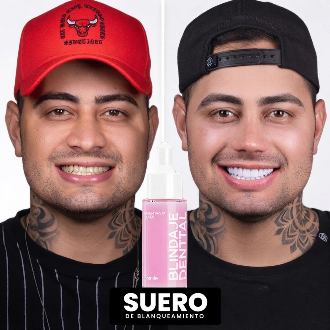 SERUM BLANQUEADOR | Reparación + Blanqueamiento | Aclara al Instante