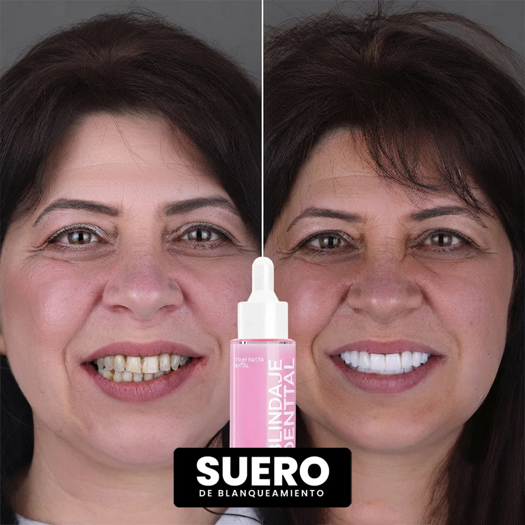 SERUM BLANQUEADOR | Reparación + Blanqueamiento | Aclara al Instante