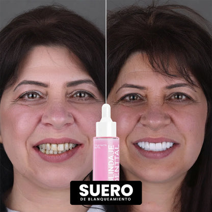 SERUM BLANQUEADOR | Reparación + Blanqueamiento | Aclara al Instante