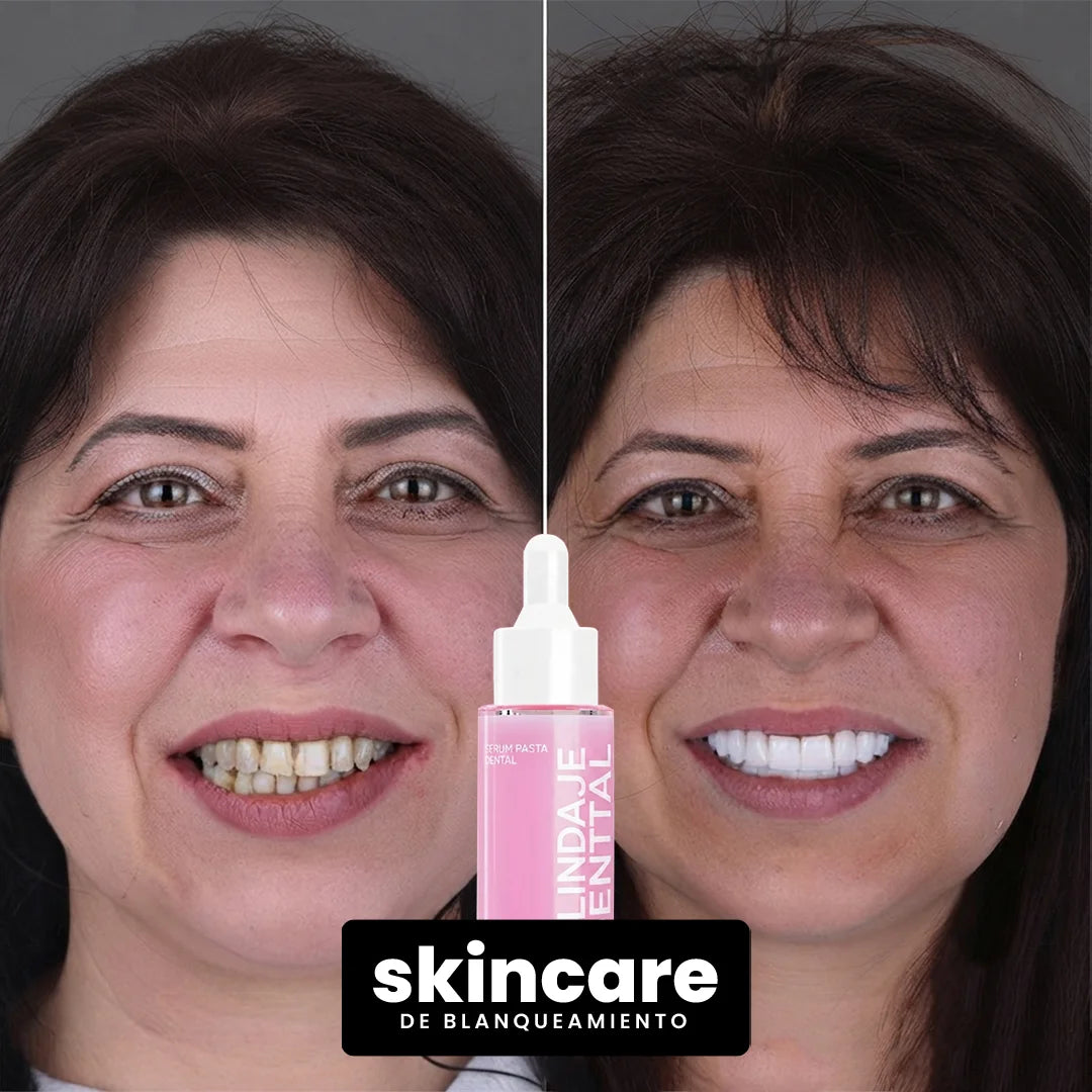 SERUM BLANQUEADOR | Reparación + Blanqueamiento | Aclaramiento progresivo