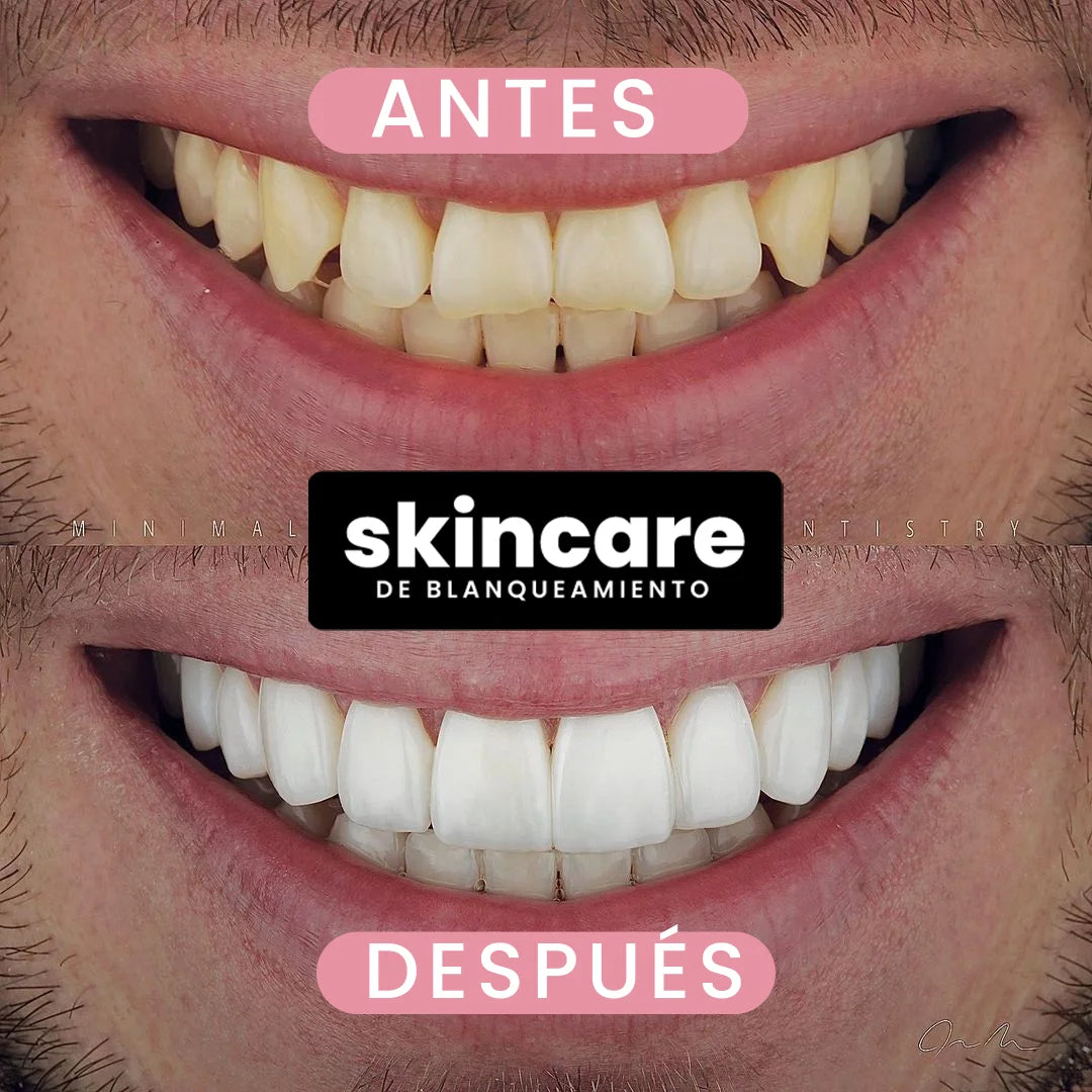 SERUM BLANQUEADOR | Reparación + Blanqueamiento | Aclaramiento progresivo
