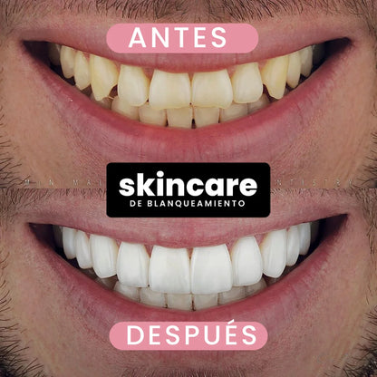 SERUM BLANQUEADOR | Reparación + Blanqueamiento | Aclaramiento progresivo