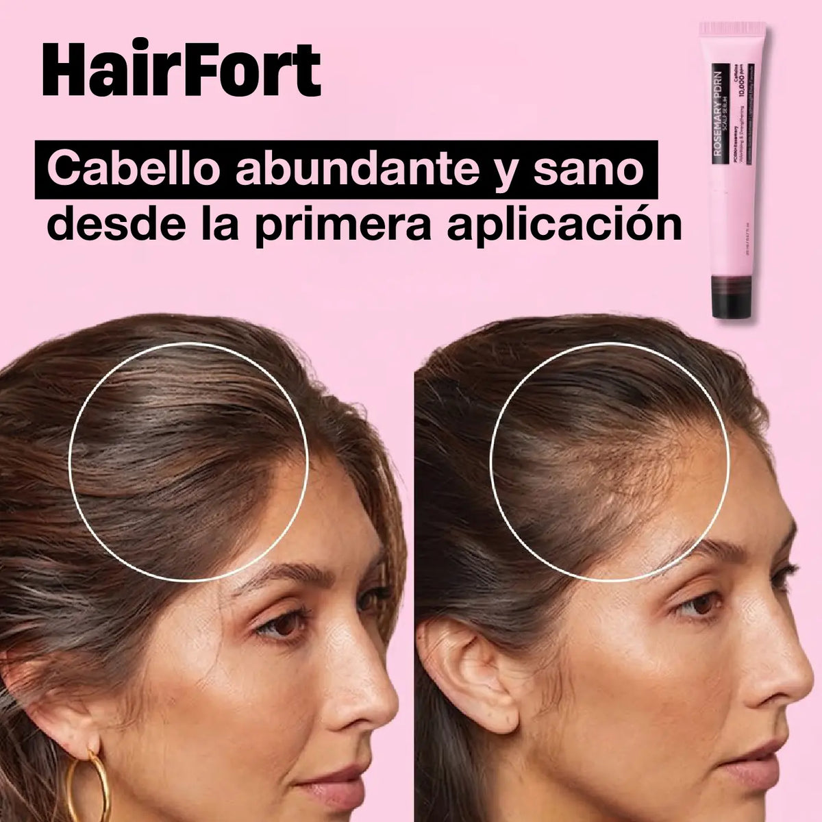 HAIRFORT | TRATAMIENTO PARA EL CRECIMIENTO Y FORTALECIMIENTO DE CABELLO