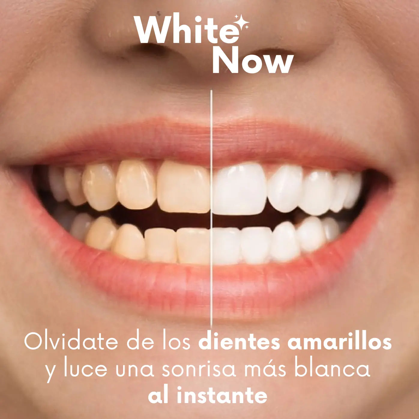 ADICIONAL ESMALTE BLANQUEADOR DENTAL WhiteNow™