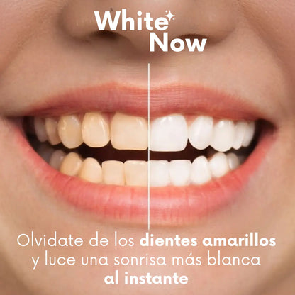 ADICIONAL ESMALTE BLANQUEADOR DENTAL WhiteNow™