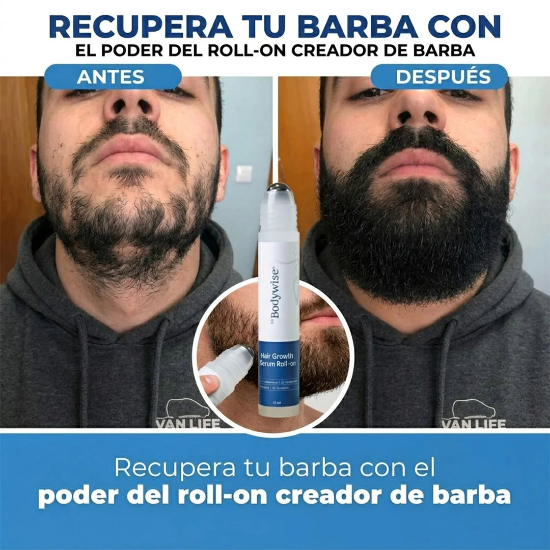 RAÍZ VIVA® SERUM ROLL-ON  Producto Más Vendido | Adiós caída, hola volumen.