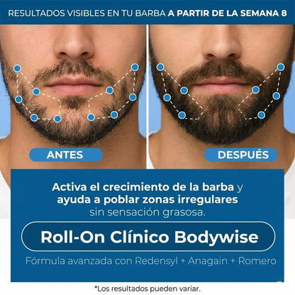 RAÍZ VIVA® SERUM ROLL-ON  Producto Más Vendido | Adiós caída, hola volumen.