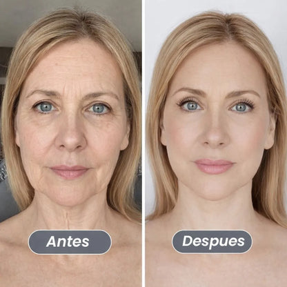 Tensor de Contorno linfático™ | Revitaliza y Esculpe tu Rostro 💆‍♀️🔥 PRODUCTO TENDENCIA