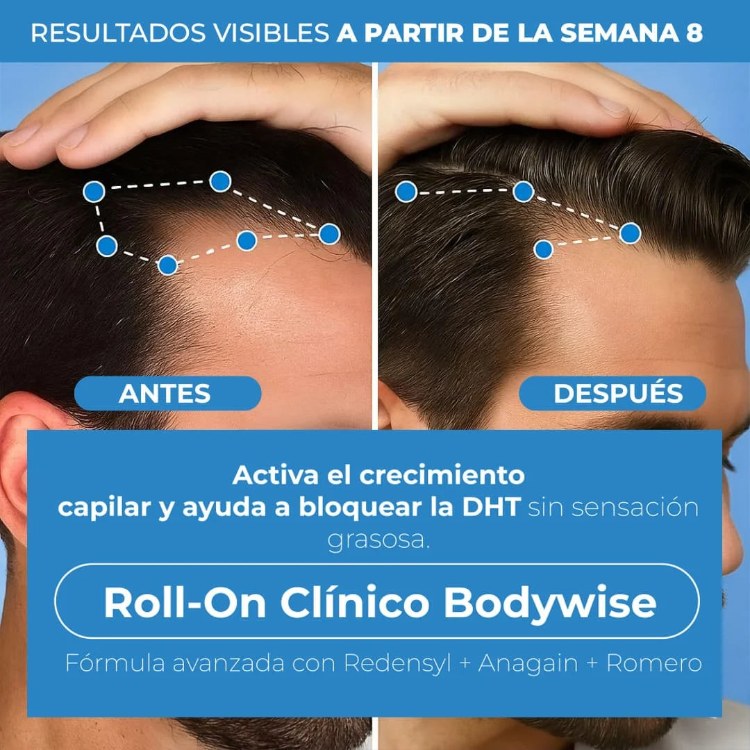 RAÍZ VIVA® SERUM ROLL-ON  Producto Más Vendido | Adiós caída, hola volumen.