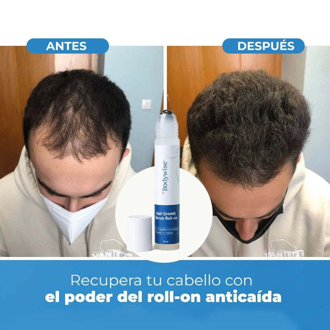 RAÍZ VIVA® SERUM ROLL-ON  Producto Más Vendido | Adiós caída, hola volumen.
