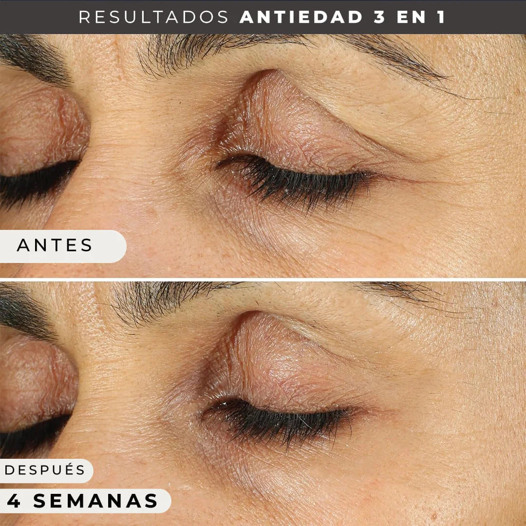ROC Contorno de Ojos Antiedad 👁️ | Reduce Ojeras, Bolsas y Arrugas