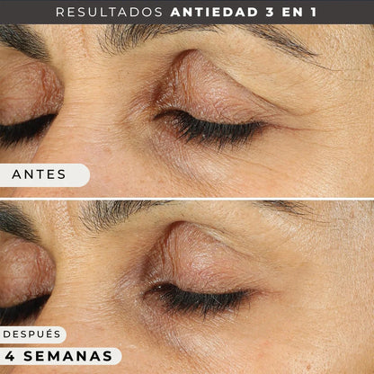 ROC Contorno de Ojos Antiedad 👁️ | Reduce Ojeras, Bolsas y Arrugas
