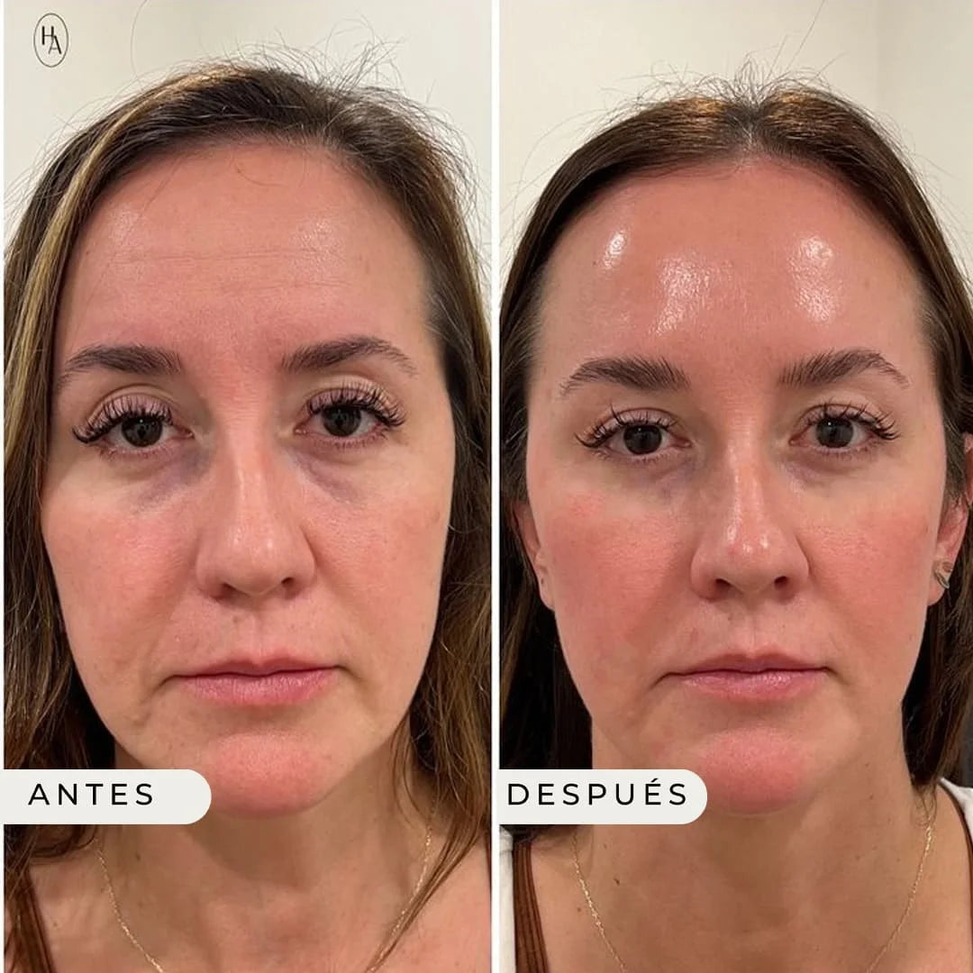 ROC Contorno de Ojos Antiedad 👁️ | Reduce Ojeras, Bolsas y Arrugas