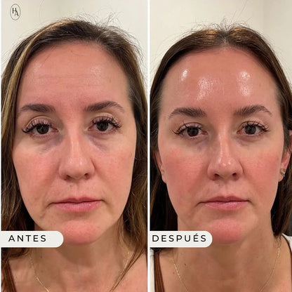 ROC Contorno de Ojos Antiedad 👁️ | Reduce Ojeras, Bolsas y Arrugas