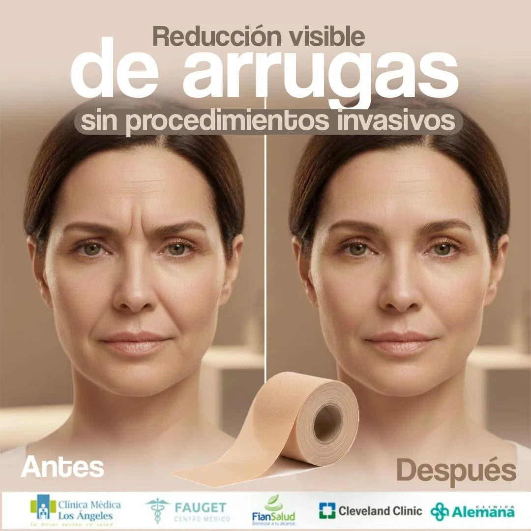 Bella Tape® – Parches de Silicona de Uso Dermatológico Anti-Arrugas