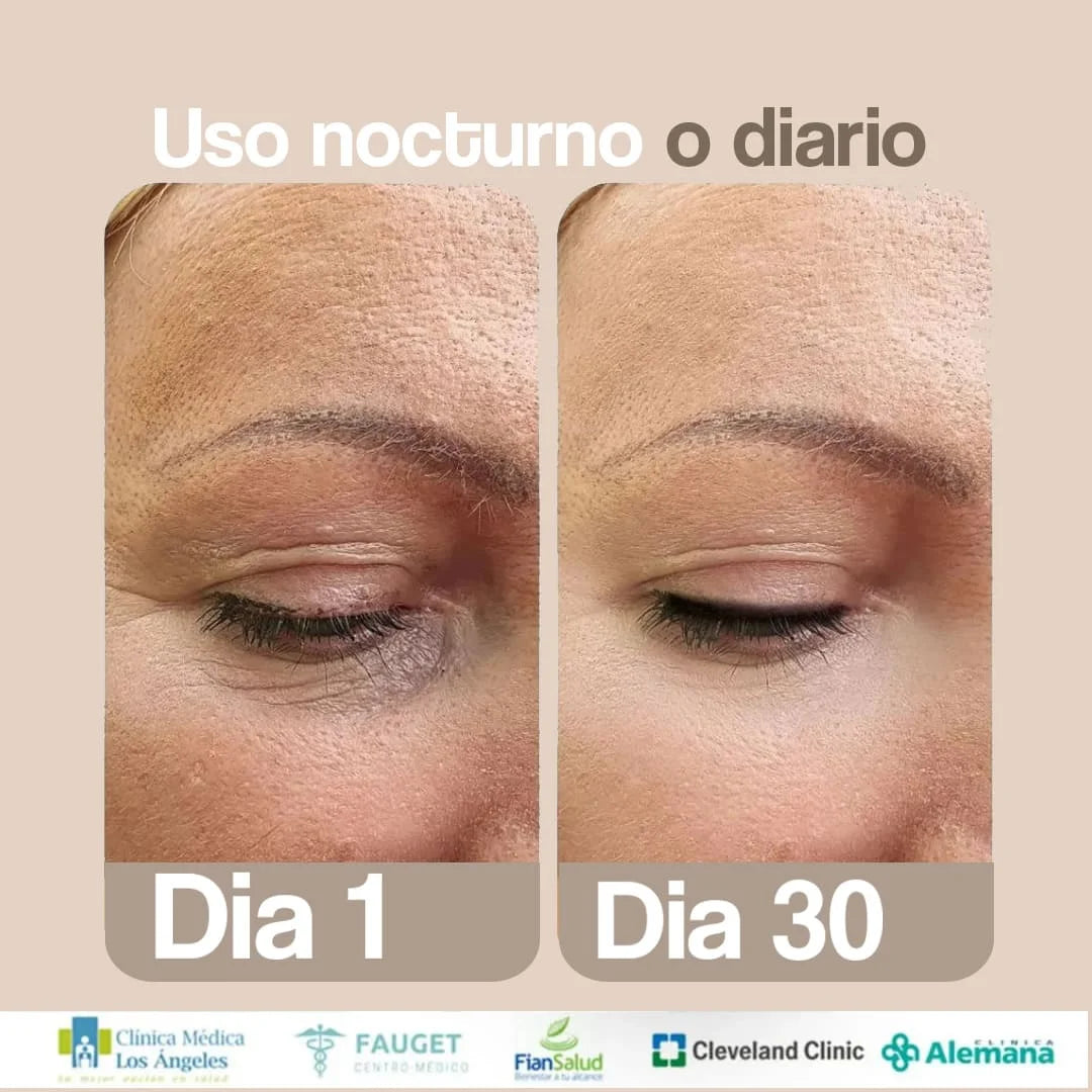 Bella Tape® – Parches de Silicona de Uso Dermatológico Anti-Arrugas